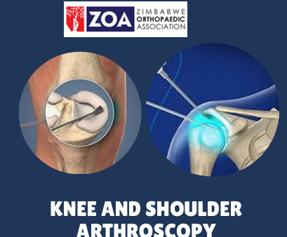 Knee & Shoulder Arthroscopy Workshop 2025